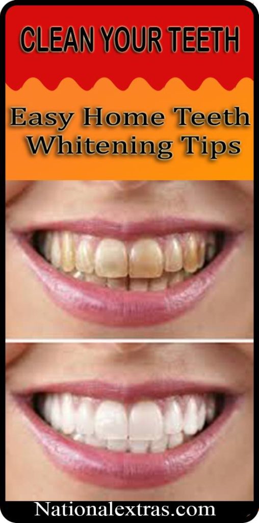 Easy Home Teeth Whitening Tips-Do it yourself