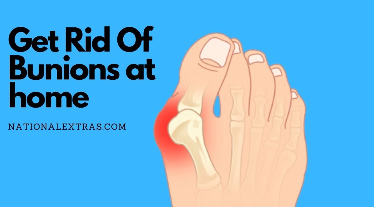 Get rid of bunions